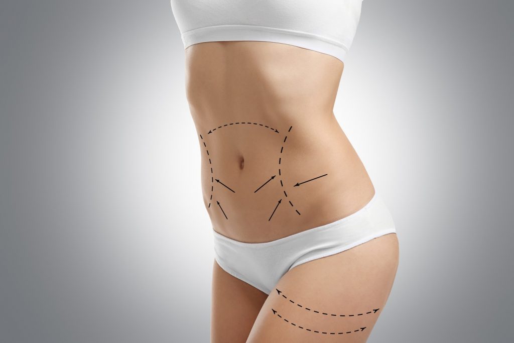 Tummy Tuck in Pune | Abdominoplasty in Pune - Deccan Clinic
