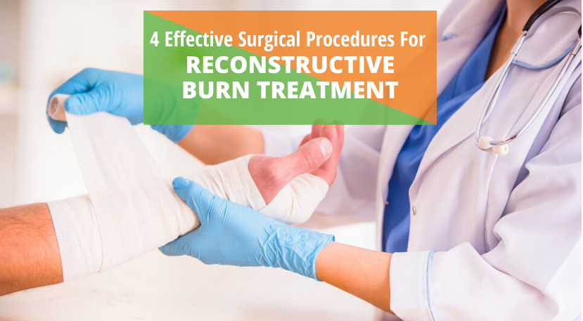 4 EFFECTIVE SURGICAL PROCEDURES FOR RECONSTRUCTIVE BURN TREATMENT