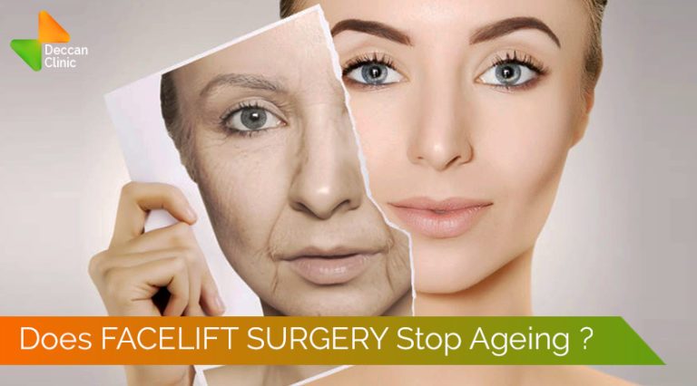 Does FACELIFT SURGERY Stop Ageing?