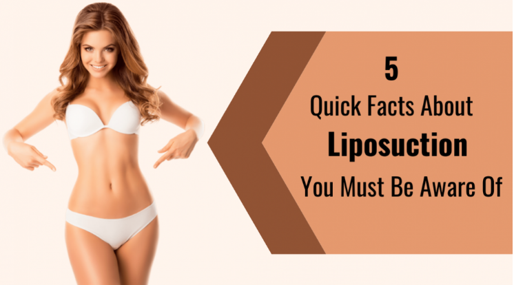 5 Quick Facts About Liposuction You Must Be Aware Of