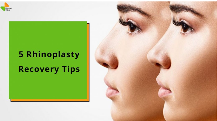 5 Crucial Tips to Ensure Prompt & Safe Recovery After Rhinoplasty Surgery