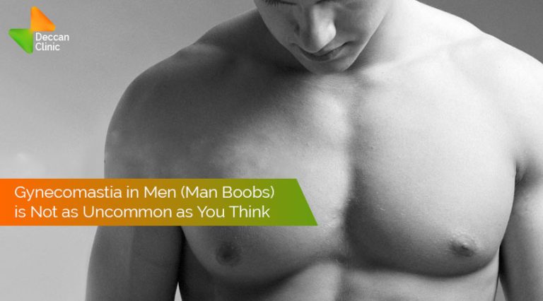 Gynaecomastia in Men (Man Boobs)