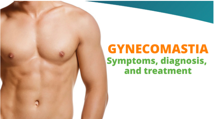 GYNECOMASTIA – SYMPTOMS, DIAGNOSIS, AND TREATMENT