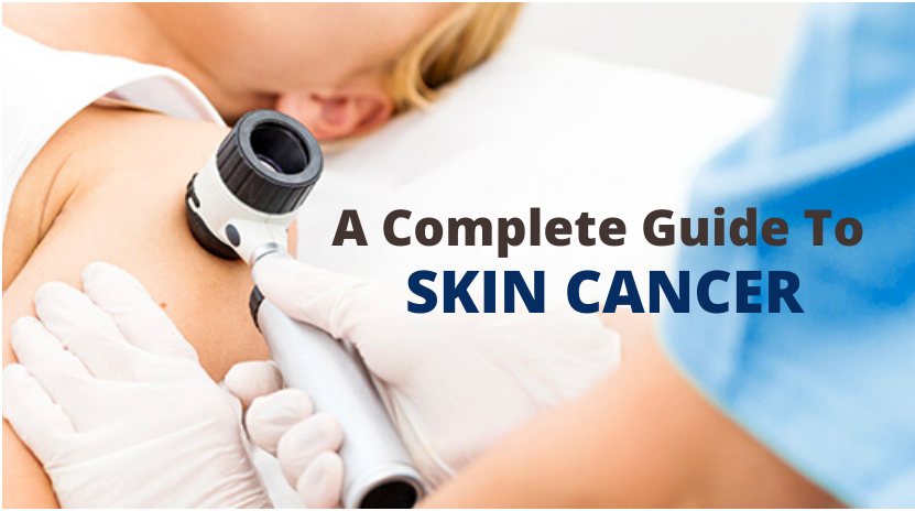 A COMPLETE GUIDE TO SKIN CANCER