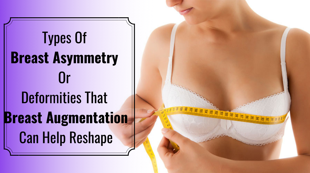 Types Of Breast Asymmetry Or Deformities That Breast Augmentation Can Help Reshape